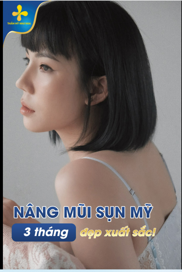 NÂNG MŨI SAU 3 THÁNG SẼ NHƯ THẾ NÀO?