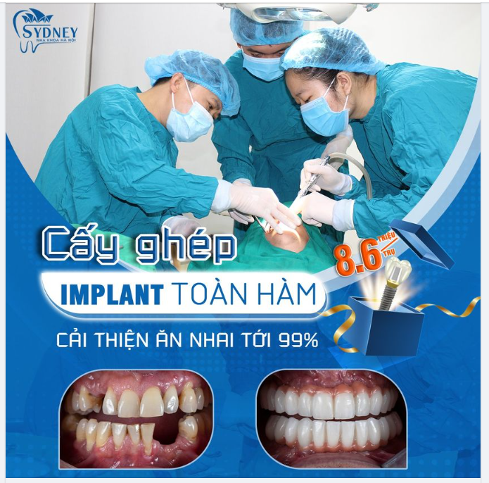 Cải thiện ăn nhai cho người già bằng cấy ghép Implant