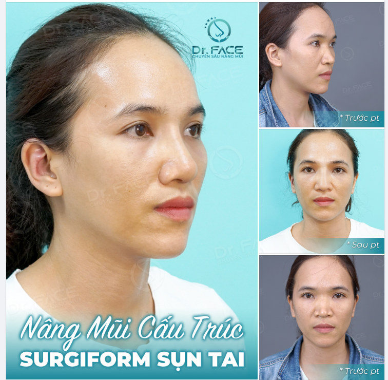 Bên sông một đóa hoa cười. Bèo trôi lãng đãng tình người an nhiên...