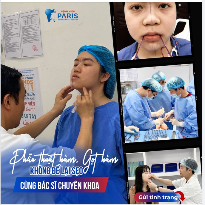 PHẪU THUẬT HÀM NHƯNG KHÔNG THẤY SẸO Ở HÀM! TẠI SAO?
