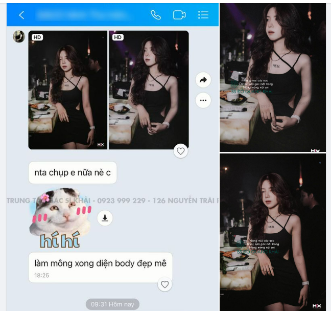 ÔNG TRỜI TẠO ĐỊA CHẤN CÒN BÁC SĨ KHẢI THÌ TẠO NÊN ĐIỂM NHẤN VỚI COMBO NÂNG MÔNG, CẮT MÍ VÀ NÂNG MŨI CẤU TRÚC