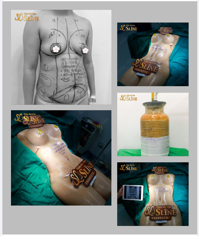 Tháng mới BODY mới Hình ảnh khách hàng thực hiện combo