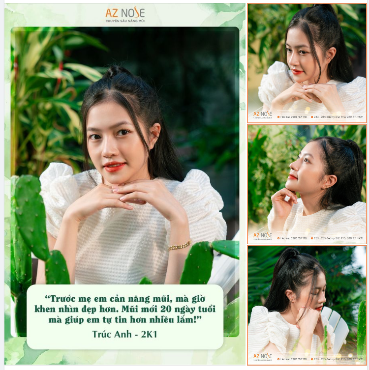 Nét đẹp trong trẻo của nàng Gen Z sau 20 ngày nâng mũi