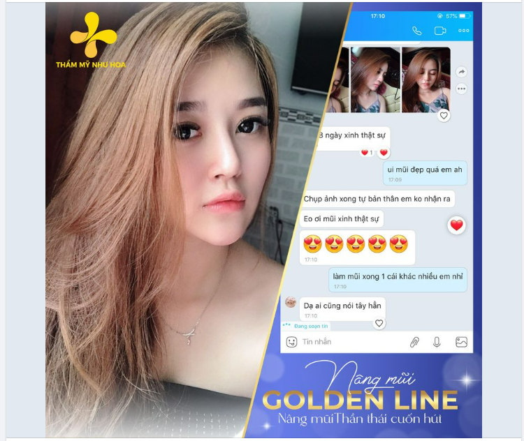 TẠM BIỆT GÓC NGHIÊNG NHẠT NHOÀ! Nâng mũi GOLDEN LINE - GIẢI PHÁP HIỆU QUẢ cho: