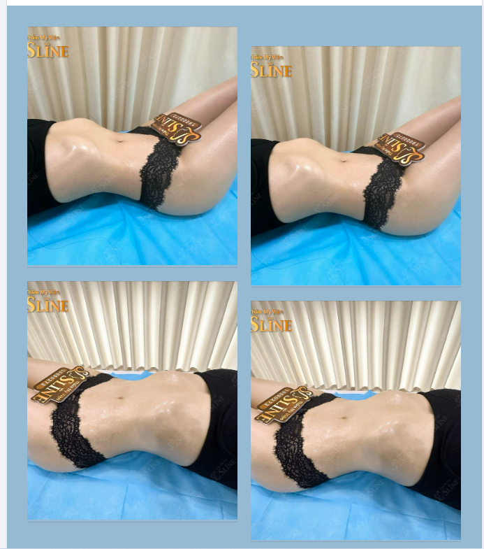 Chị ơi! em không đồng ý với kết quả sau phẫu thuật đâu?