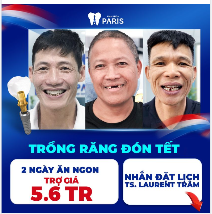 CUỐI NĂM TRỒNG RĂNG - ĂN NGON KỊP TẾT