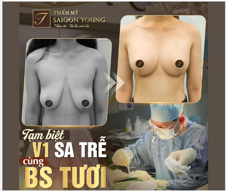 TẠM BIỆT VÒNG 1 SA TRỄ CÙNG BS TƯƠI