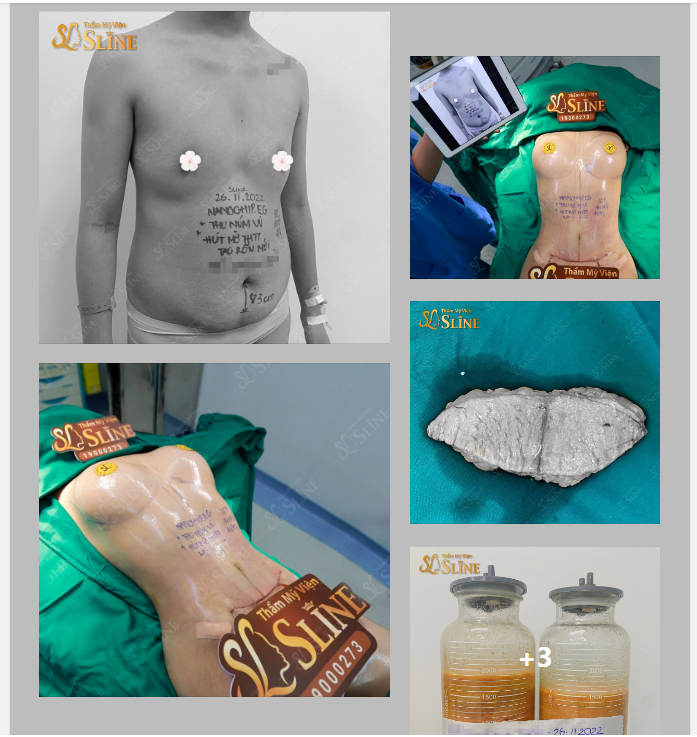 THÁNG 11 Cơ hội làm đẹp với ưu đãi cực kỳ hấp dẫn