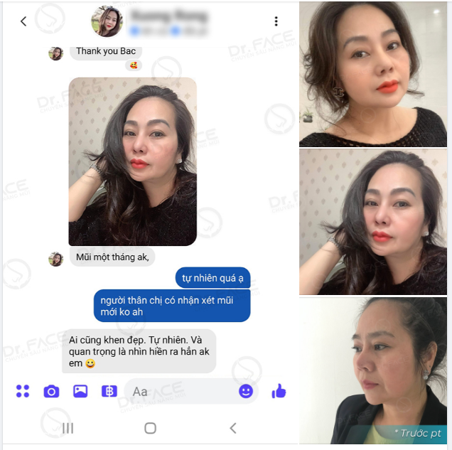 NHƯ NÀY BẢO SAO BÁC SĨ HAY KHOE???