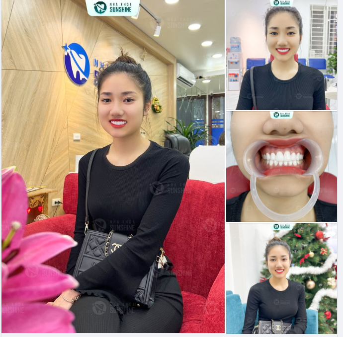 Sunshine là nha khoa hội tụ đầy đủ các yếu tố đó. Hàng ngàn khách hàng trong và ngoài nước đã tin tưởng và trải nghiệm.