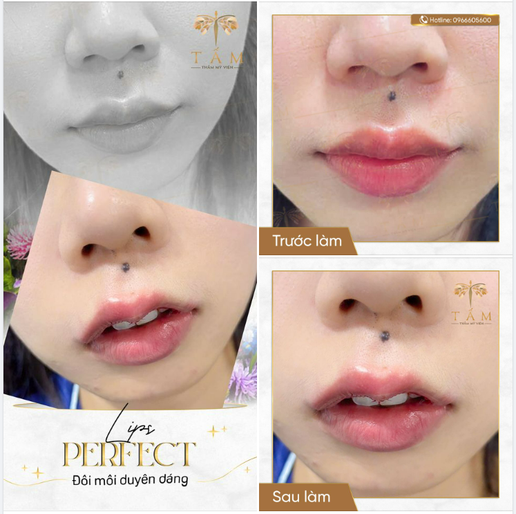 BÍ MẬT ĐẰNG SAU NHỮNG ĐÔI MÔI TRÁI TIM