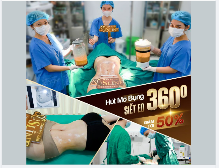 HÚT MỠ SIẾT EO 360 ﾟ