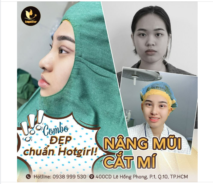 COMBO ĐẸP CHUẨN HOTGIRL NÂNG MŨI + CẮT MÍ