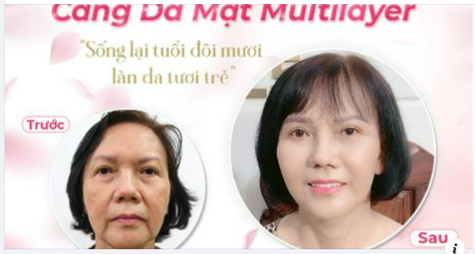1.5 THÁNG TRẺ RA 10 TUỔI SỰ THẬT LÀ GÌ???