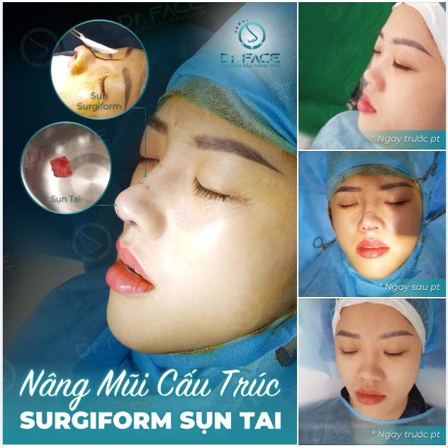 Một cô gái biết tăng giá trị của mình sẽ luôn làm người đàn ông cảm thấy thu hút.