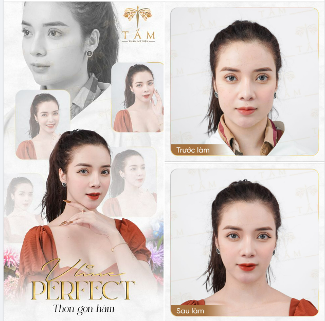 NÂNG CẤP BẢN THÂN CÙNG VlinePerfect