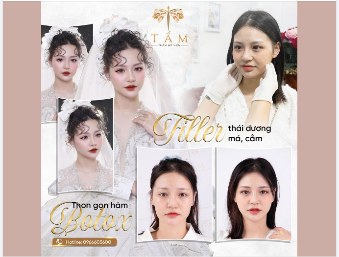 Trải nghiệm ngay combo BOTOX - FILLER biến hình gương mặt đẹp hoàn hảo chuẩn tỉ lệ vàng