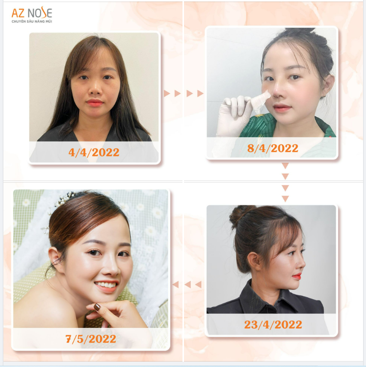 "Tự chăm sóc vết thương tại nhà đơn giản hơn em tưởng"
