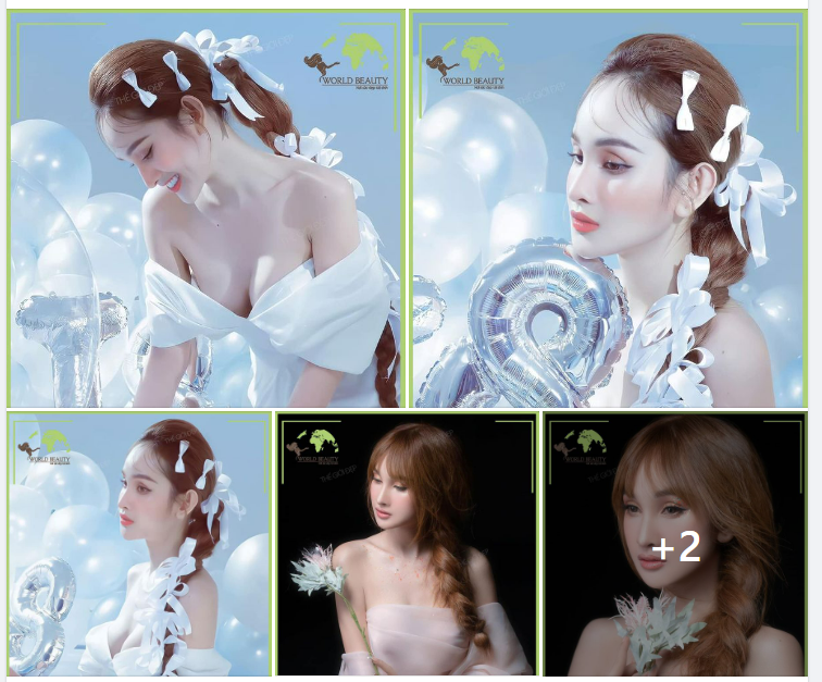 Hotgirl Cần Thơ ngày một nhuận sắc sau 6  năm Nâng mũi cấu trúc Sline sụn tự thân: