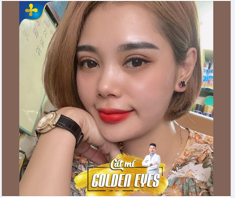 Nếp mí tự nhiên, nhanh lành sớm đẹp chính là cắt mí Golden Eyes