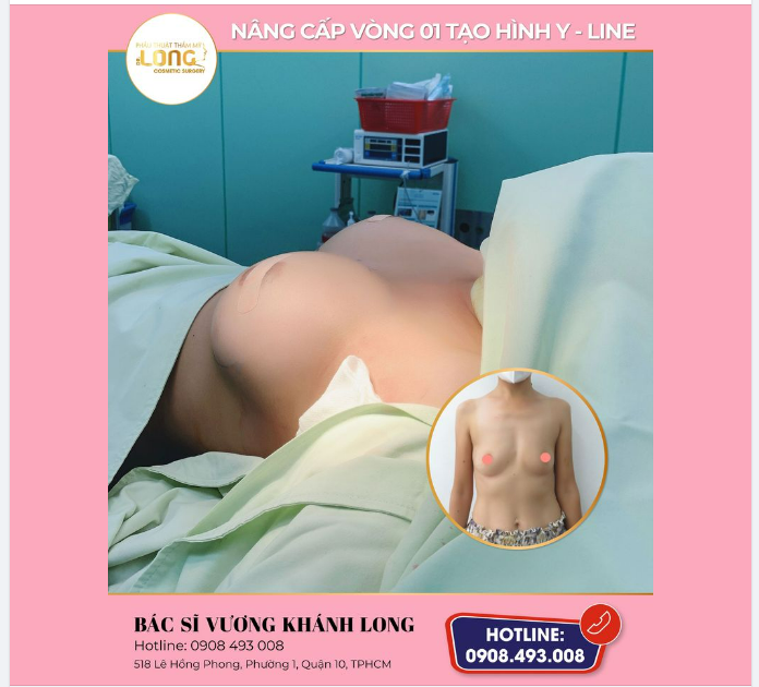 NÂNG CẤP VÒNG 1 BÂY GIỜ TẾT NÀY ĐẸP QUYẾN RŨ