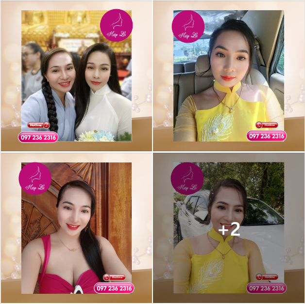NÂNG MŨI - CẮT MÍ XONG TỰ NHIÊN GHIỀN CHỤP HÌNH HẲN "