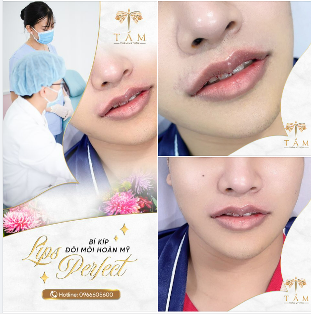 CHƯA ĐẦY 45P CÓ NGAY ĐÔI MÔI QUYẾN RŨ NHƯ Ý - TIẾT KIỆM THỜI GIAN