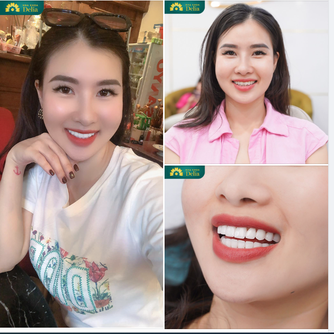 Bởi nụ cười luôn thường trực trên môi sẽ giúp chúng ta tạo ấn tượng tốt với khách hàng.