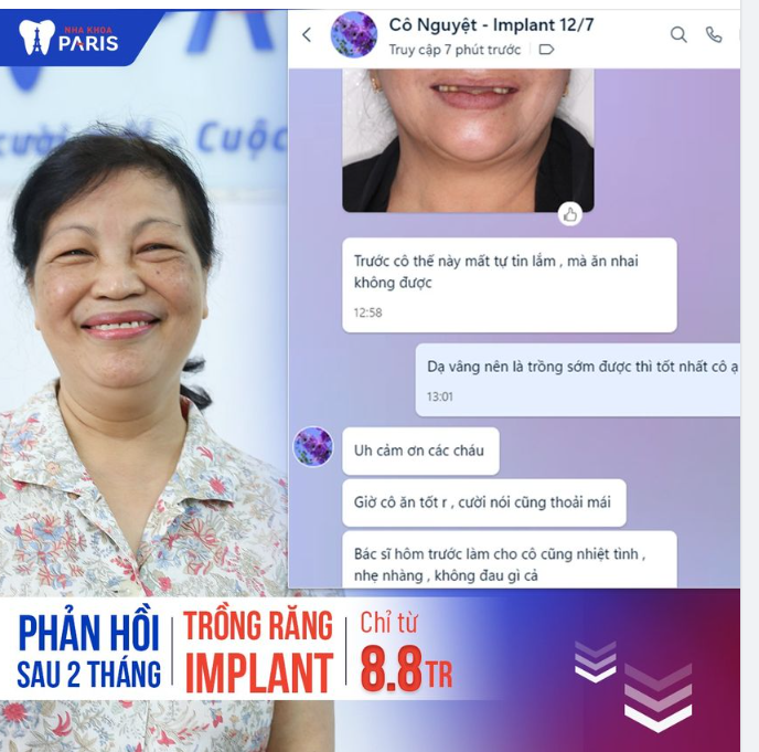 2 NGÀY TRỒNG RĂNG - ĂN NHAI TRỌN ĐỜI
