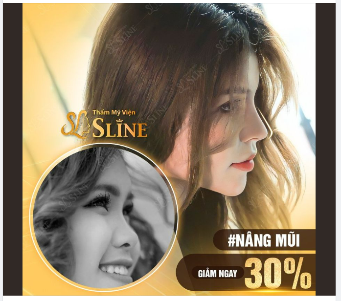 Khoe góc nghiêng thần thánh với dáng mũi mới