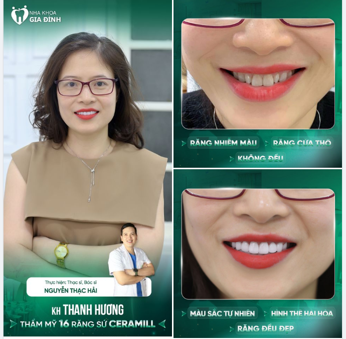SỰ THAY ĐỔI HOÀN HẢO CỦA KHÁCH HÀNG CHÍNH LÀ NHỜ TAY NGHỀ CAO CỦA BÁC SĨ