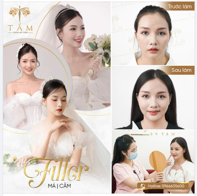 10 TIPS ĐỂ CÓ GƯƠNG MẶT THANH THOÁT, ĐẸP CHUẨN TỰ NHIÊN