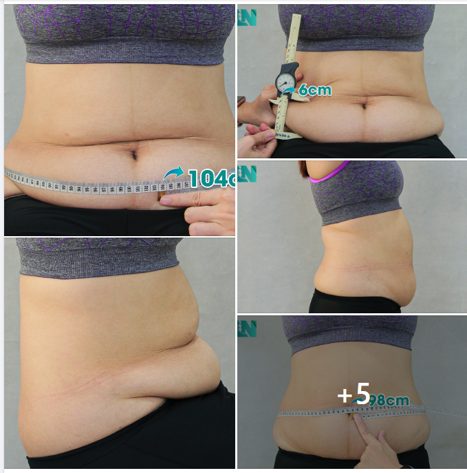 CHỊ KH 28 TUỔI ĐẾN TỪ LÂM ĐỒNG, TIN TƯỞNG GIẢI PHÁP VÌ ĐƯỢC NGƯỜI THÂN GIỚI THIỆU. 