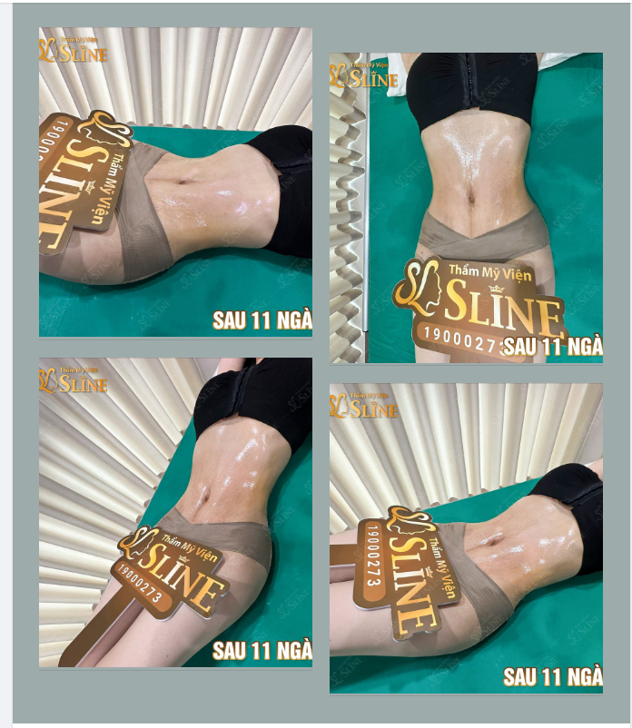 Điêu khắc BODY 360°