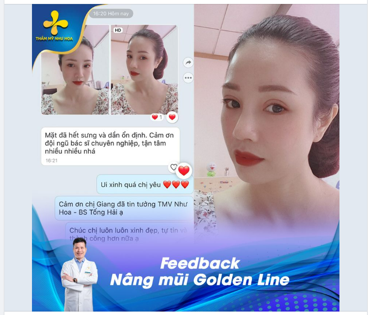 NÂNG MŨI KHÔNG CHỈ ĐỂ XINH, NÂNG MŨI LÀ ĐỂ CHỤP ẢNH KHÔNG KIÊNG GÓC NÀO