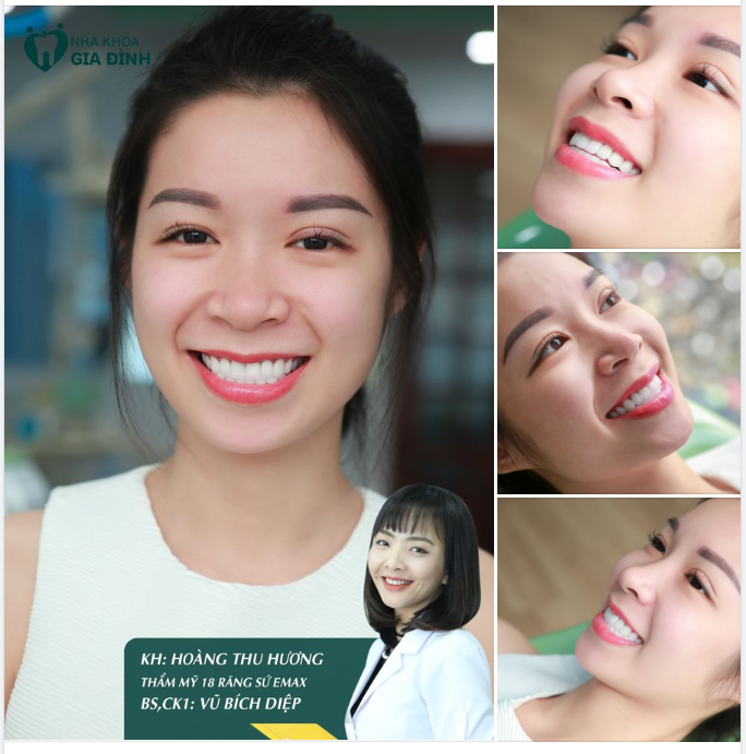 KHÔNG CÓ NỤ CƯỜI ĐẸP NHẤT CHỈ CÓ NỤ CƯỜI PHÙ HỢP NHẤT