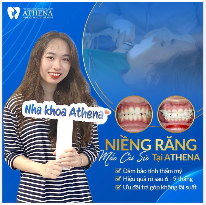 NIỀNG RĂNG MẮC CÀI SỨ - HIỆU QUẢ VÀ THẨM MỸ CAO