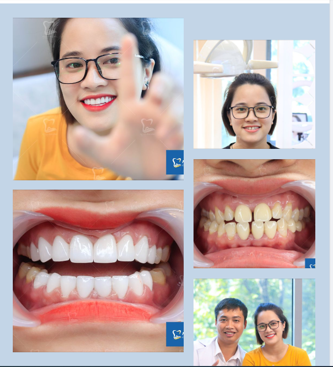 Vẫn là nụ cười ấy nhưng phiên bản rạng rỡ hơn