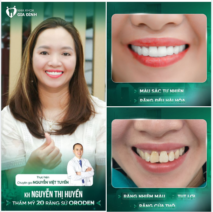 HẠNH PHÚC KHI THAY ĐỔI NỤ CƯỜI VỚI CHUYÊN GIA NGUYỄN VIỆT TUYẾN