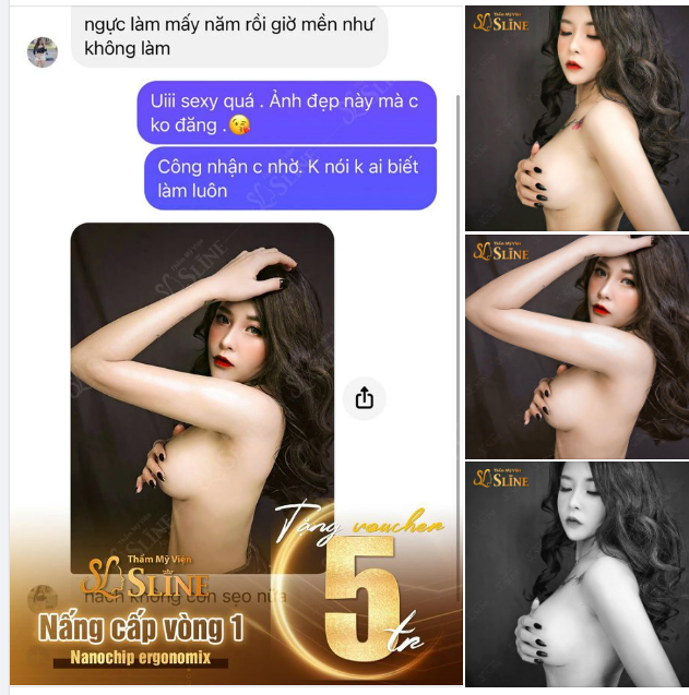 "Ngực mềm như chưa làm" feedback của khách hàng sau nâng ngực bởi Ekip Sline.