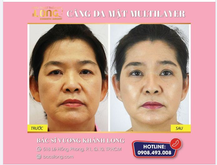 BẠN MUỐN XINH ĐẸP THEO CHÂN CHÚNG TÔI 