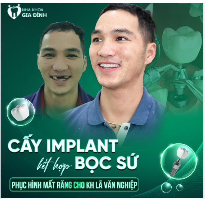 GIẢI CỨU MẤT RĂNG - PHỤC HỒI ĂN NHAI BỀN CHẮC, KHỎE NHƯ RĂNG THẬT