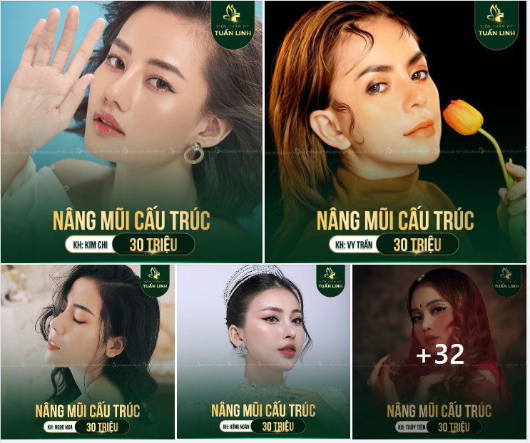 CHỈ 30 TR ĐẸP TOAND DIỆN VỚI NÂNG MŨI CẤU TRÚC 