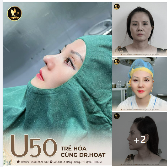 U50 TRẺ HÓA CÙNG DR. HOẠT
