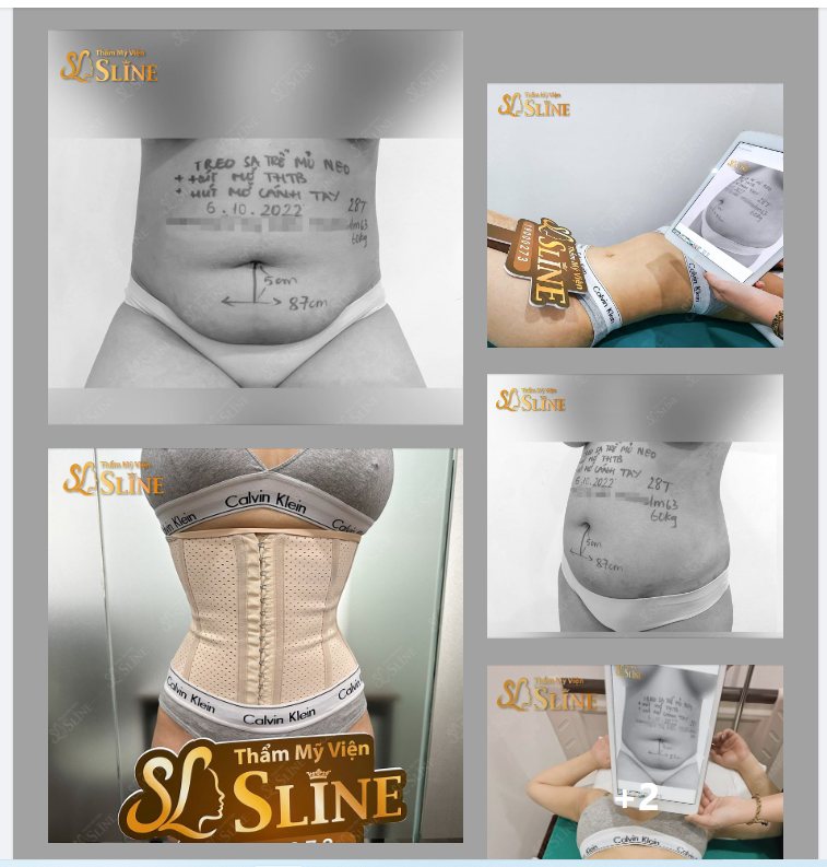 Điêu khắc body "360°"
