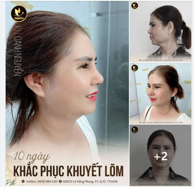 10 NGÀY KHẮC PHỤC KHUYẾT LÕM – LẤY LẠI SỰ TỰ TIN