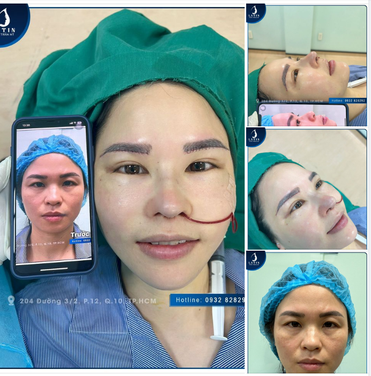 Combo cho chị khách hàng bay về từ Anh