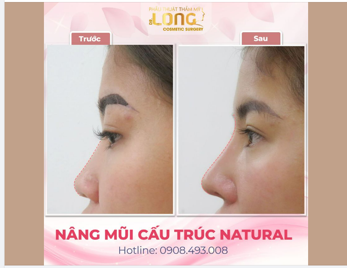 BIẾN TỰ TI THÀNH ĐIỂM TỰ HÀO