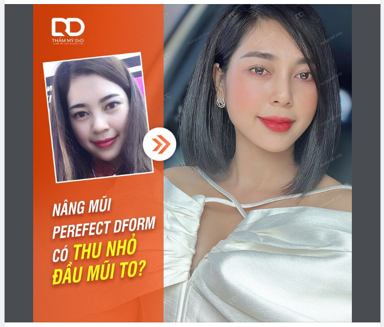 NÂNG MŨI PERFECT DFORM CÓ THU NHỎ ĐẦU MŨI KHÔNG?
