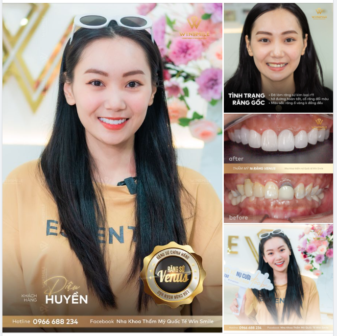 THẦN THÁI TOÁT RA TỪ NỤ CƯỜI LÀ THỨ QUÝ GIÁ NHẤT CỦA PHỤ NỮ